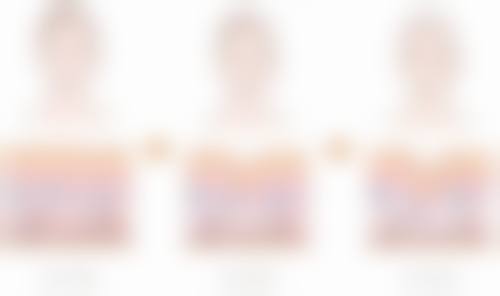 三、咬肌必须打瘦脸针吗：不打瘦脸针的瘦脸方法