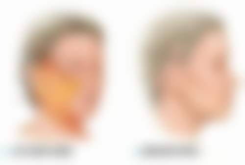 四、上海爱丽资医疗美容医院特色项目