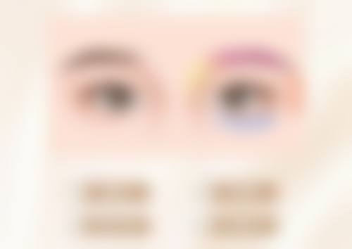 一、20岁有眼袋的形成原因