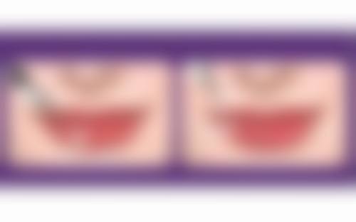 三、上海瑞金医院舟山分院烧伤整形美容科诊疗项目有哪些？