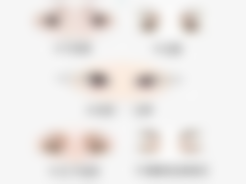 六、咬肌必须打瘦脸针吗：总结