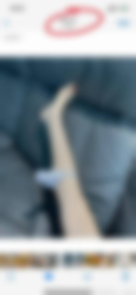 九、上海瑞金医院舟山分院烧伤整形美容科真实的患者评价