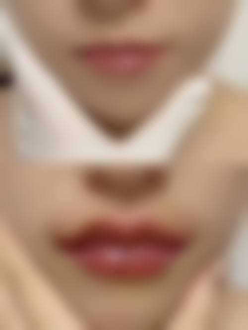 二、上海瑞金医院舟山分院烧伤整形美容科怎么样？