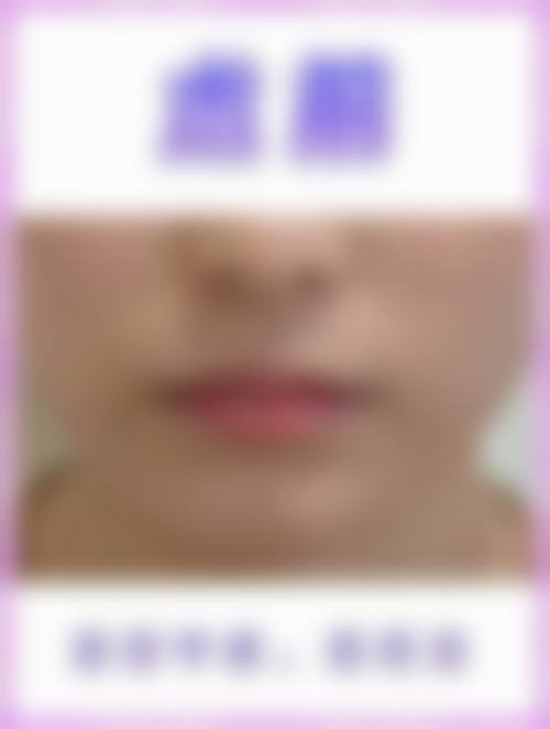 五、上海瑞金医院舟山分院烧伤整形美容科医生介绍