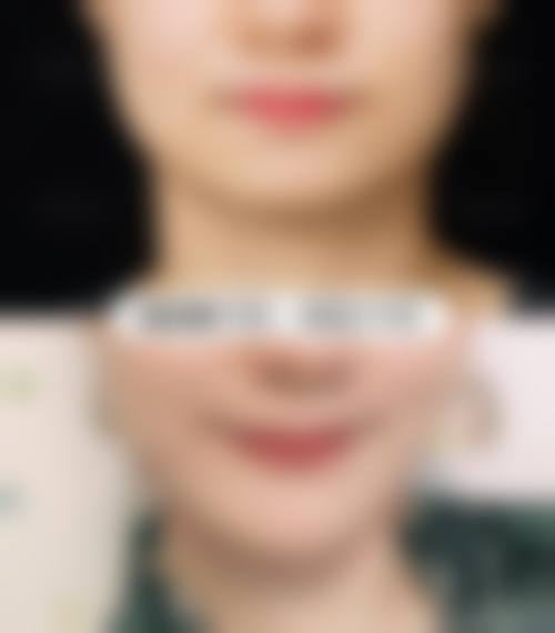 二、北京市第六医院整形美容外科怎么样？