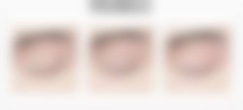 八、江西俏佳人整形医疗美容门诊部真实的患者评价