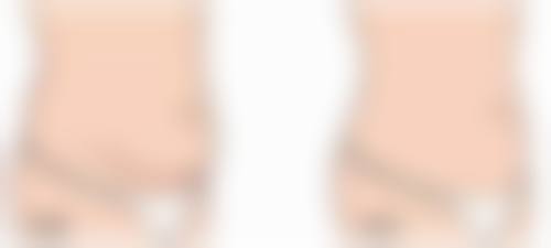 五、汉寿金典美集医疗美容诊所价格表