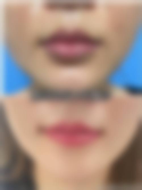 二、郑州安佳医学美容诊所怎么样？