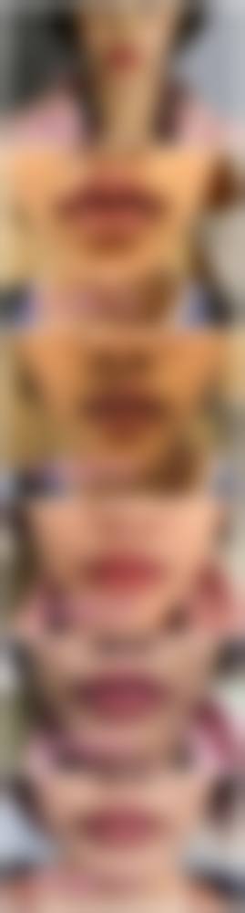 五、郑州安佳医学美容诊所价格表