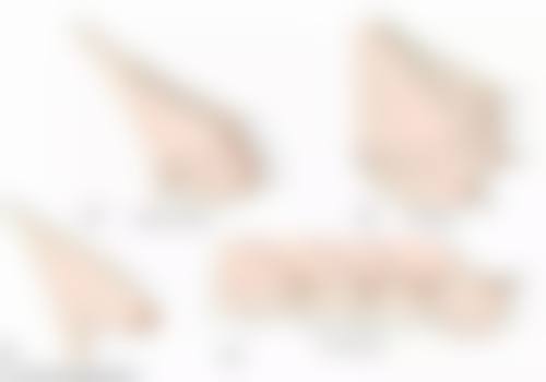 七、结尾:双眼皮定型霜如何打开