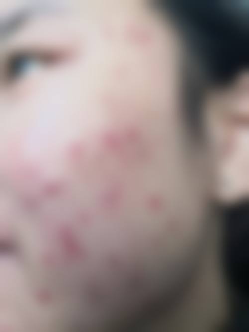 三、潘启红技术优势