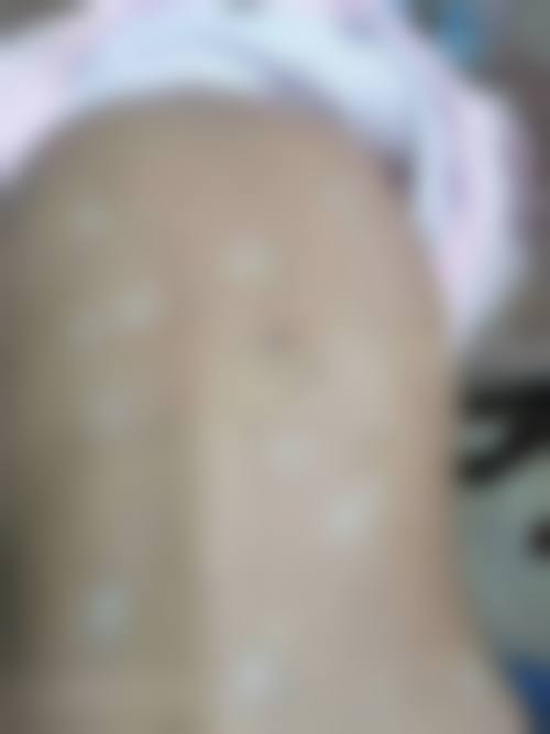 五、潘启红怎么预约?