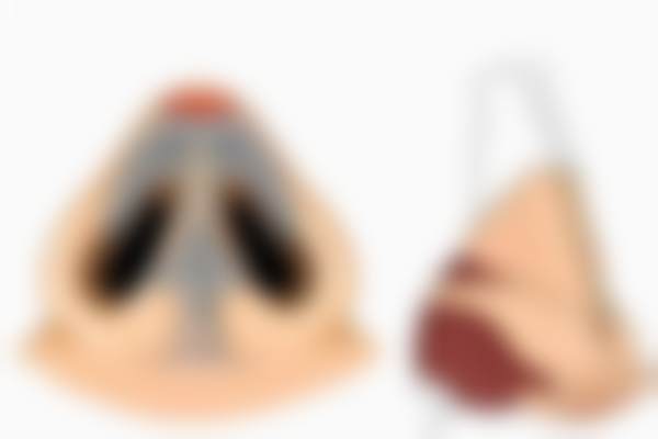 三、北京蕾士悦容医生团队的专精优势