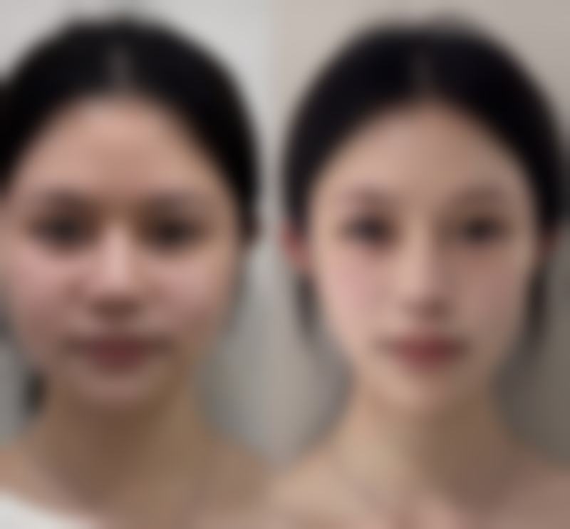 四、抽脂手术会有危险吗？规避危险的方法