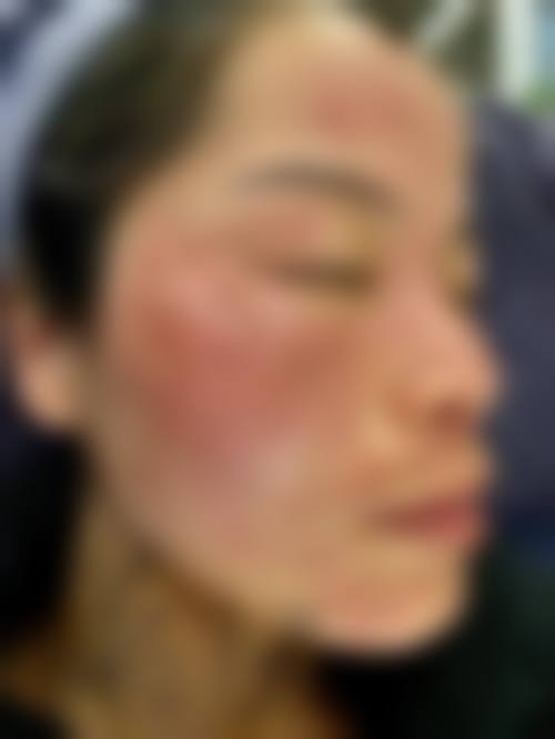 三、郑静技术优势
