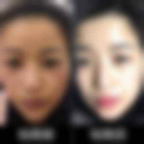 五、郑静怎么预约？
