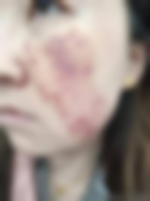 三、连云港媚眼整形医疗美容门诊部诊疗项目有哪些？