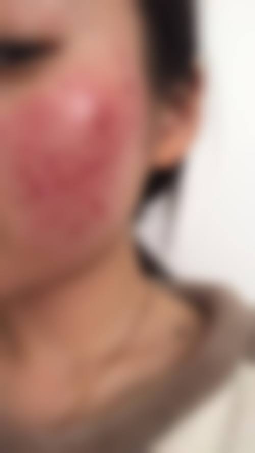 八、连云港媚眼整形医疗美容门诊部预约方式