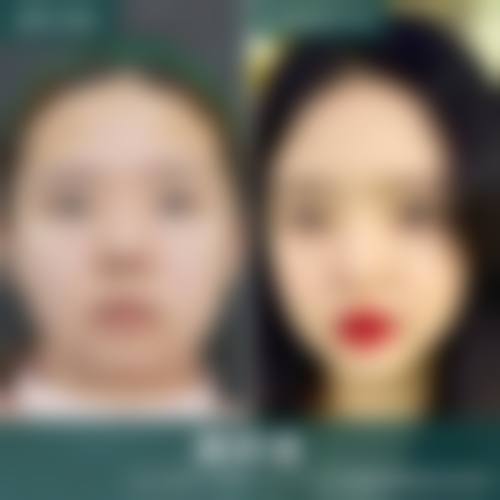 六、温树森真实的患者评价