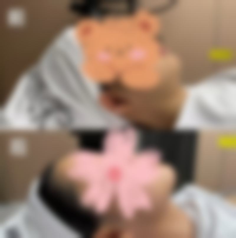 二、韩国POINT整形外科怎么样？