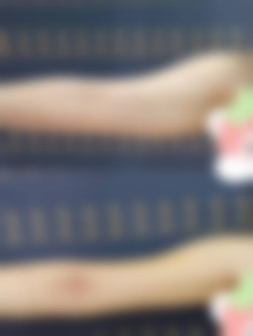 五、常德豆蔻年华整形医院价格表