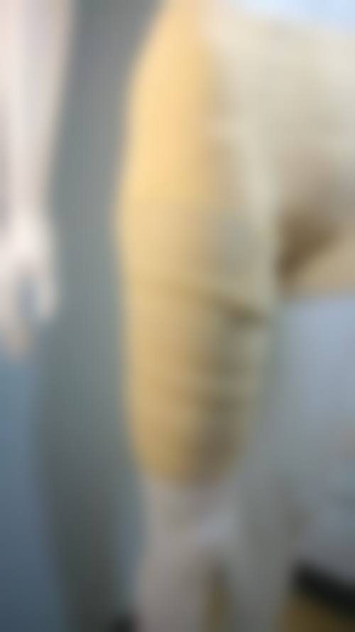 九、西安美立方整形美容医院真实的患者评价