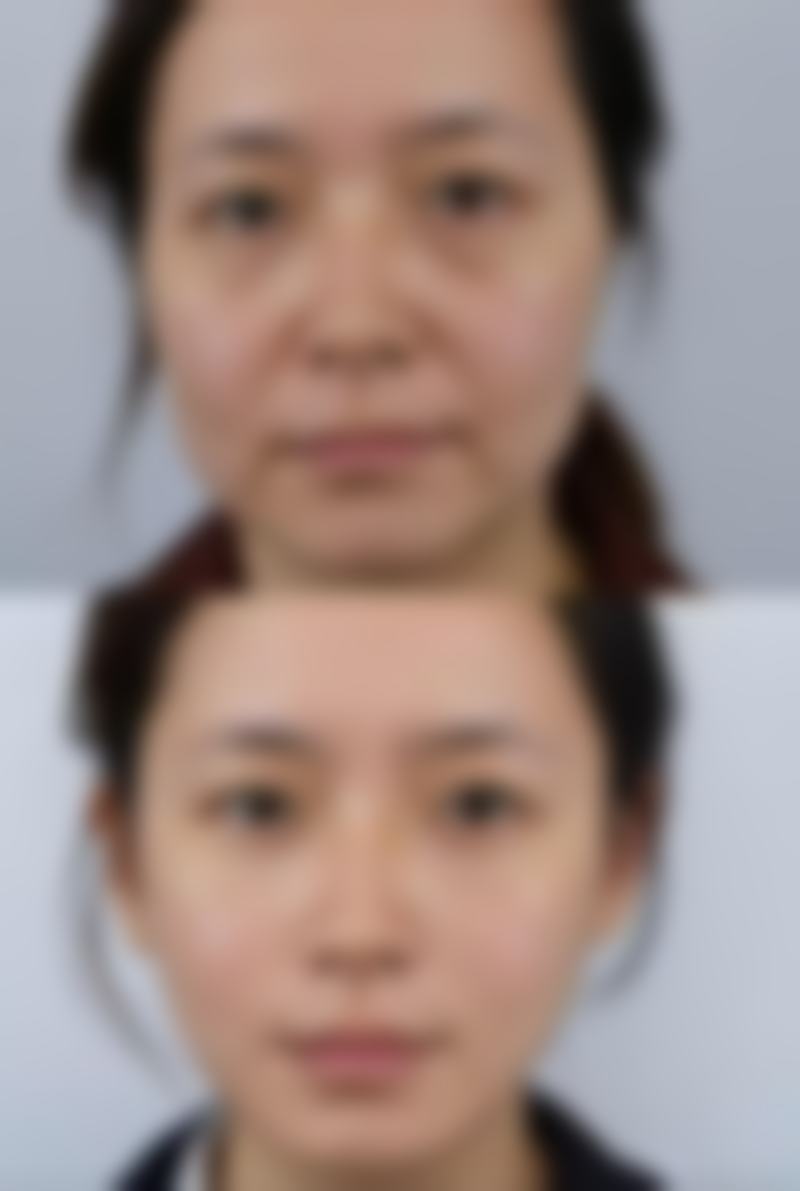 八、常德豆蔻年华整形医院真实的患者评价
