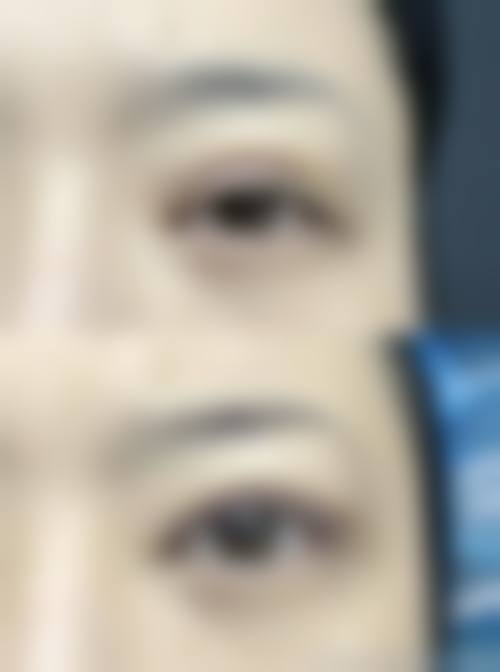 二、韩国爱丽克整形怎么样？