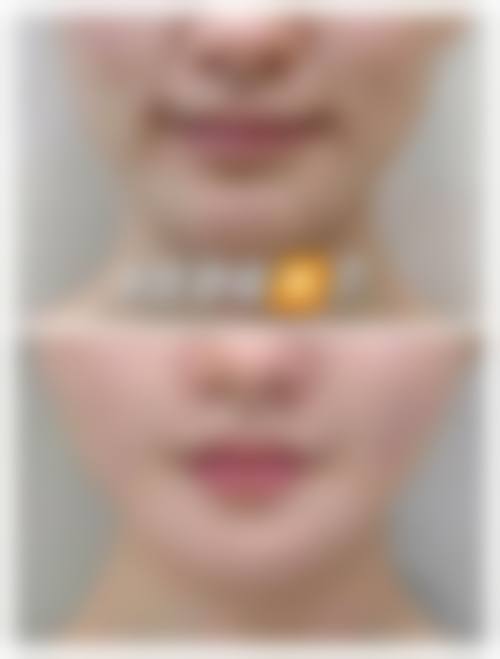 三、湘潭美颜医疗美容诊所诊疗项目有哪些？