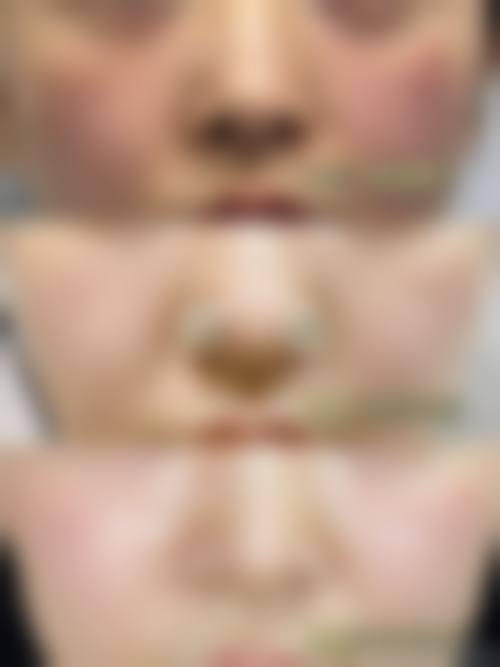 九、郑州郑东熙朵医疗美容诊所真实的患者评价