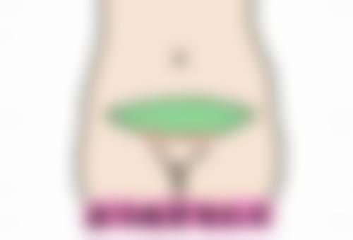 一、多年凹疤痕形成的原因