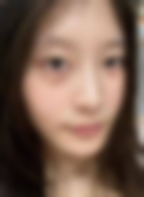 九、毕节市第二人民医院皮肤美容科真实的患者评价