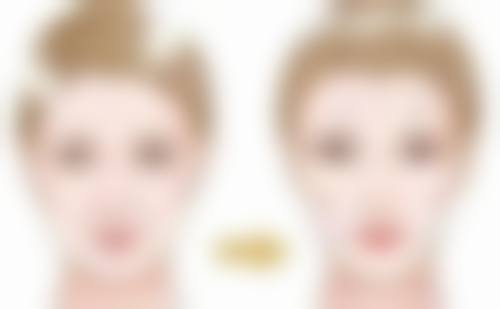 怎样去掉眼袋有效果？调整作息、激光治疗、手术等方法大揭秘！ 