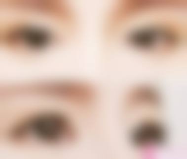 九、大连爱丁医疗美容真实的患者评价