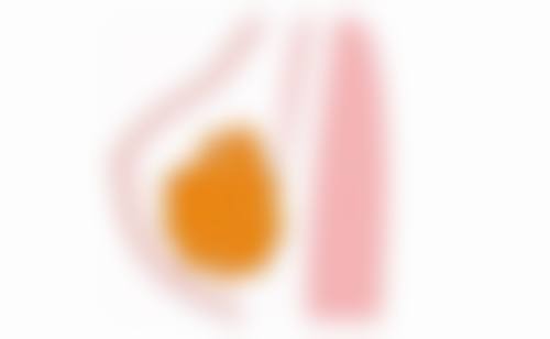 二、眼部护理消掉熬夜的眼袋