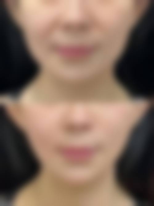 二、临泉华康皮肤医院医疗美容科怎么样？