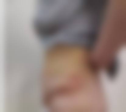 二、郑州市第三人民医院整形美容科怎么样？