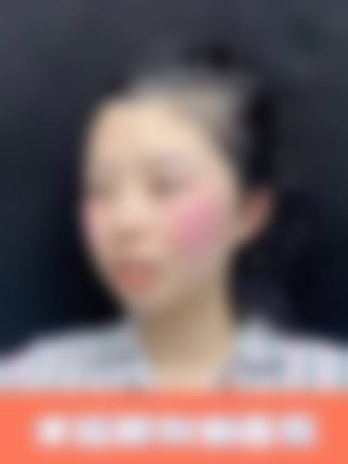 四、临泉华康皮肤医院医疗美容科特色项目