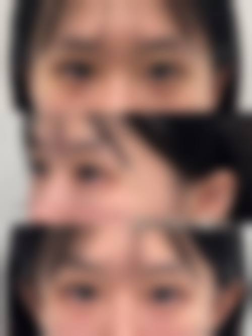 四、成都龙成欧菲医疗美容诊所特色项目