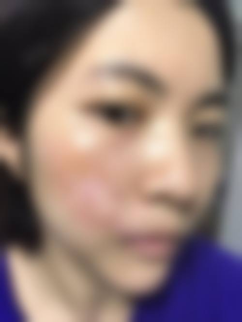 八、杭州广仁整形美容医院真实的患者评价