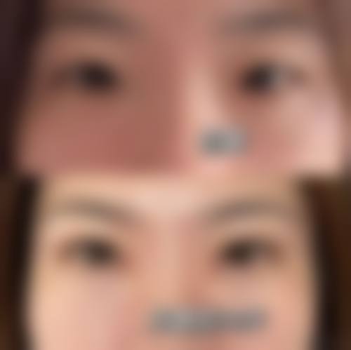 四、海口美兰红妆整形医院特色项目