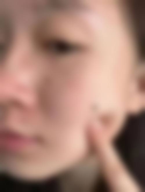 二、全仁基擅长项目