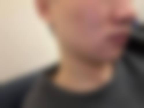 八、厦门思明璀璨新辰整形医院真实的患者评价