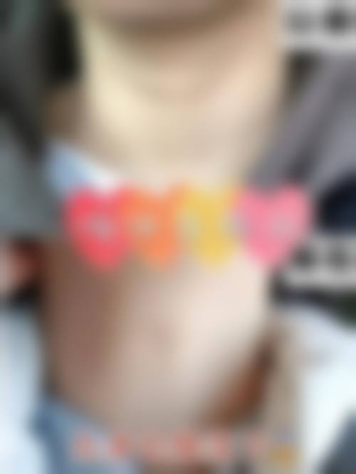 二、眉山悦美医疗美容整形门诊部怎么样?