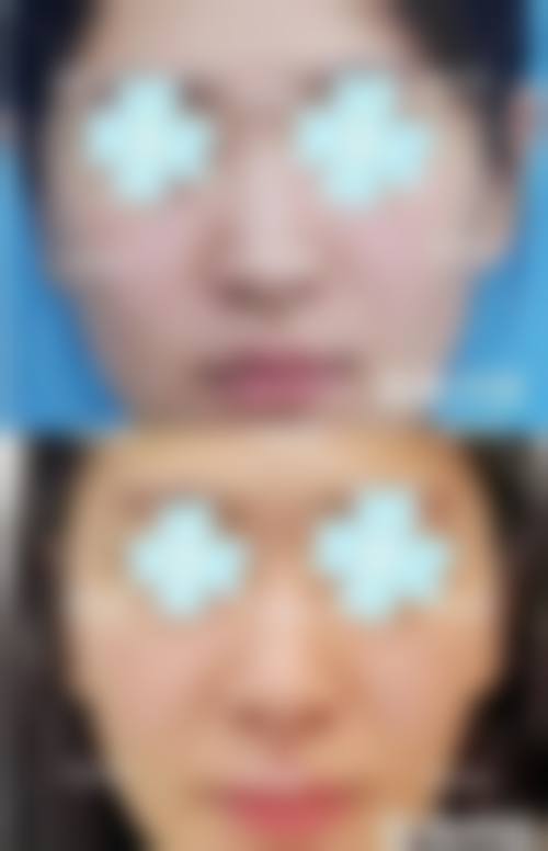 七、眉山悦美医疗美容整形门诊部预约方式