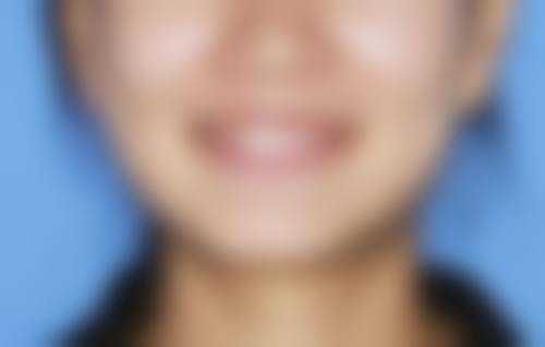 三、眉山悦美医疗美容整形门诊部诊疗项目有哪些?