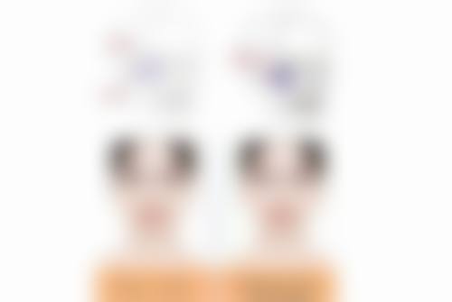 二、长久变双眼皮的方法——双眼皮整形手术