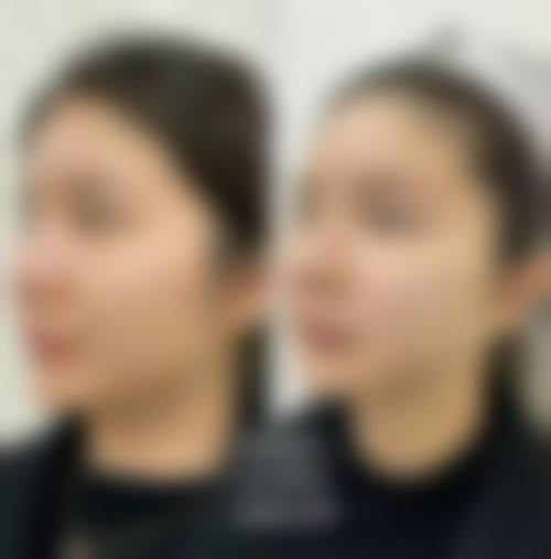 五、崔奉均怎么预约?