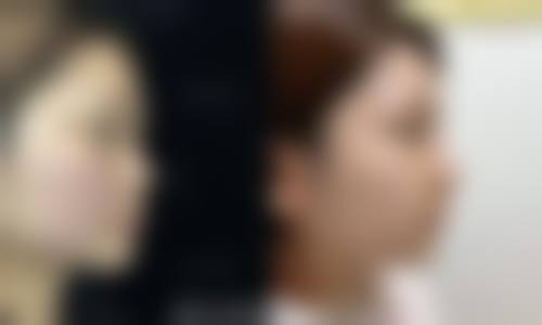九、吉林华悦整形医院真实的患者评价