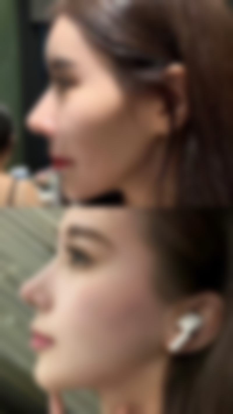 四、做了双眼皮多久可以化妆?化妆前后的注意事项